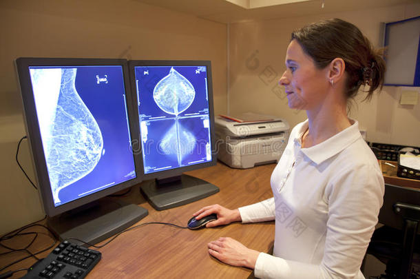 放射技师检查乳房X光检查
