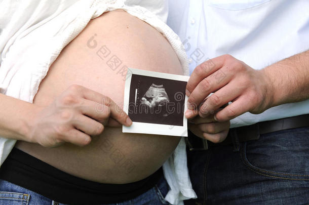 怀孕：夫妇抱着婴儿的超声波图像