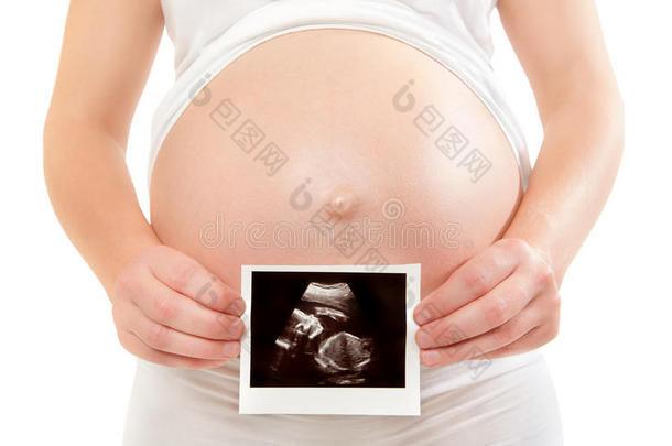 孕妇手持超声波照片