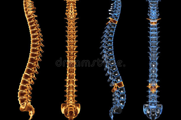 脊柱和脊柱x光片