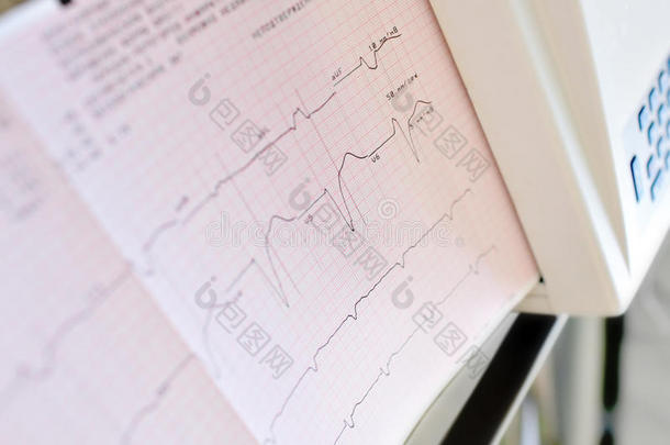 心电图打印