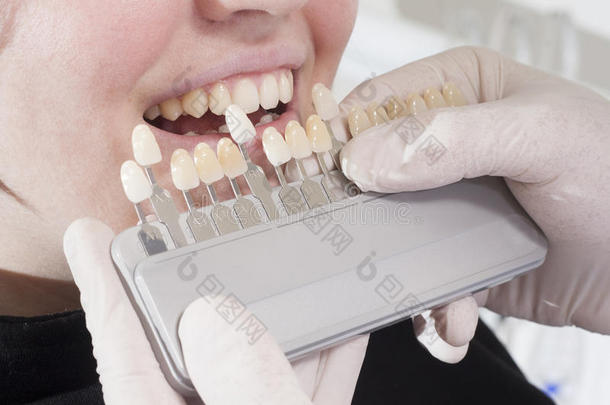 牙医选择洁白的牙齿