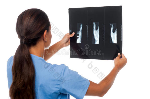 女医生看病人的x光片报告