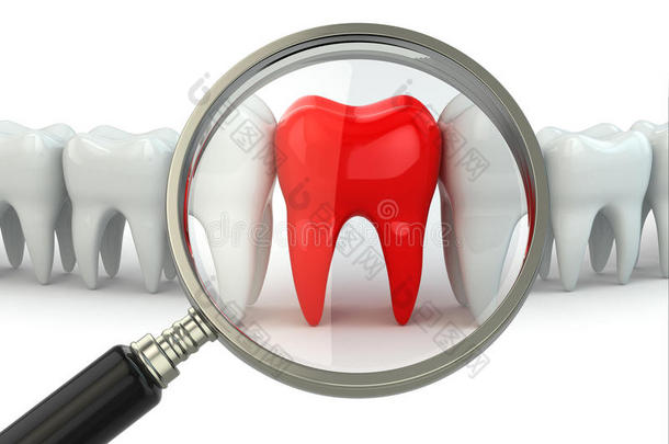 在一排健康牙齿中寻找疼痛的牙齿。