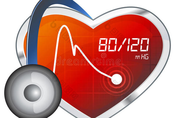 血压监测-图示