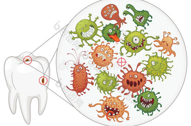 龋齿。有趣的细菌和牙齿