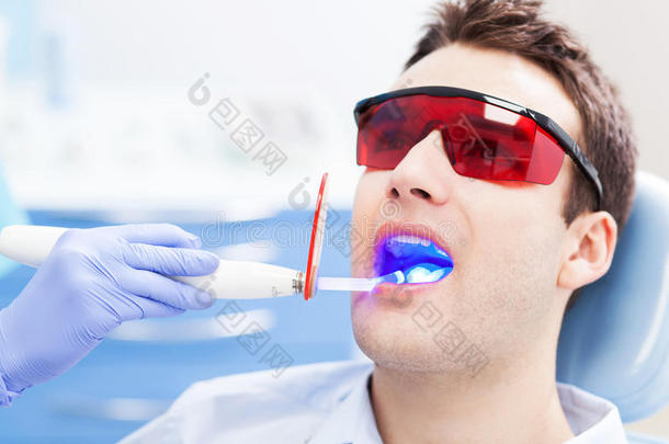 牙科紫外线灯设备
