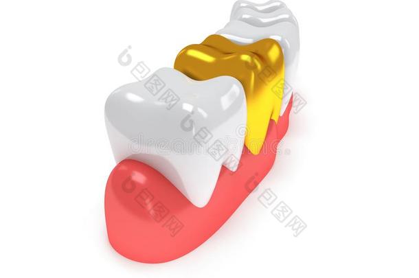 洁白的牙龈上的牙齿。