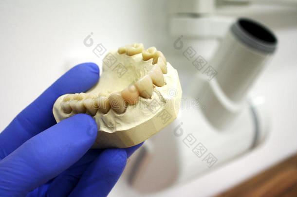 左手持牙模型（chop），背景为牙科x射线管头