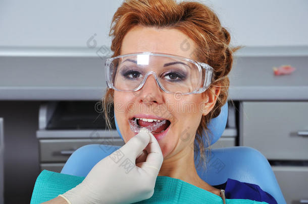 牙医插入夹板