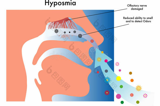 嗅觉减退