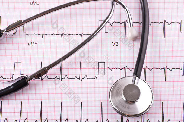 心电图心脏病学照顾诊断设备