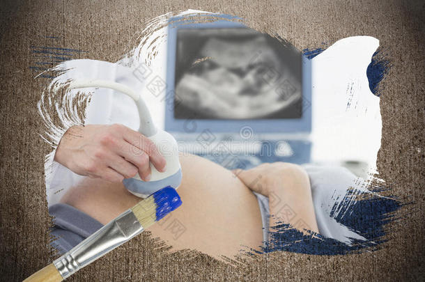 孕妇接受超声检查的合成图像