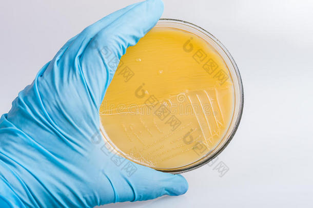 手拿手套，拿着细菌培养皿，在<strong>生化实验室</strong>工作。