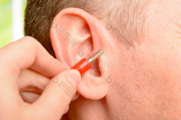 耳穴疗法