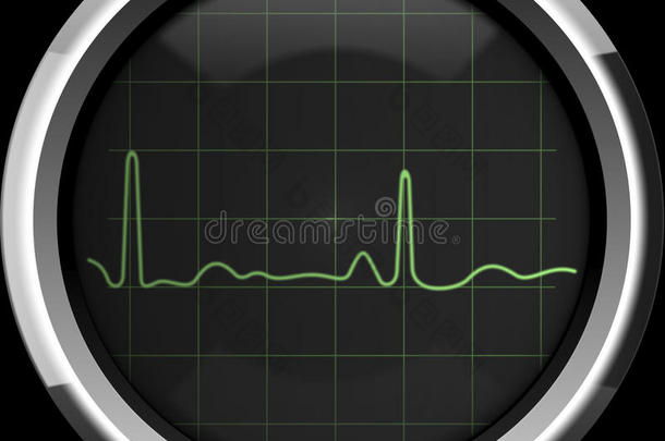 心脏监护仪屏幕上的心电图显示为绿色