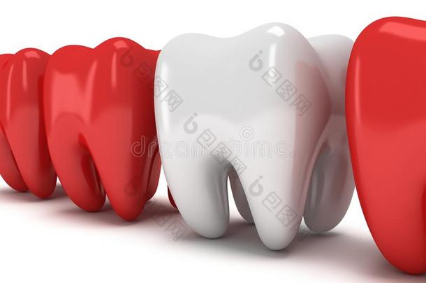 健康的<strong>牙齿</strong>排在一排疼痛的<strong>牙齿</strong>里