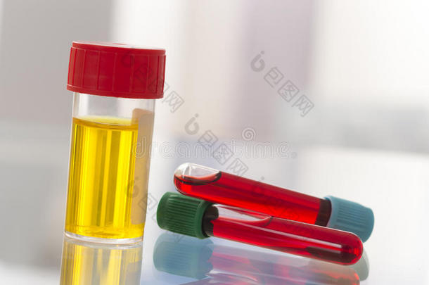 医学检验：无菌尿样和血液检验