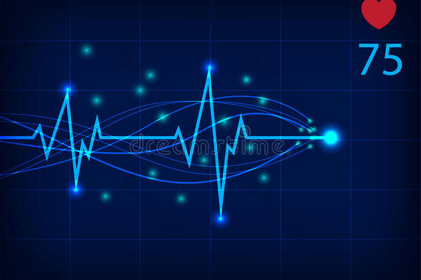 心电监护仪显示向量图