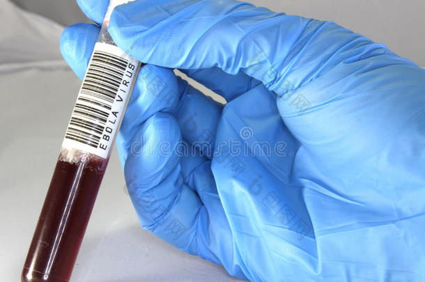 实验室里的埃博拉血样试管
