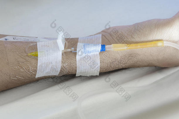病人手臂静脉注射针