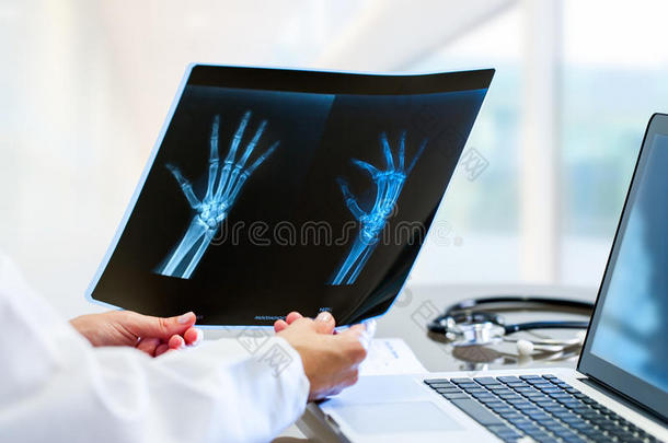 医生手拿着x光片在桌子上。