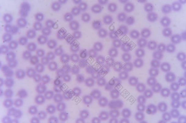血涂片：红细胞