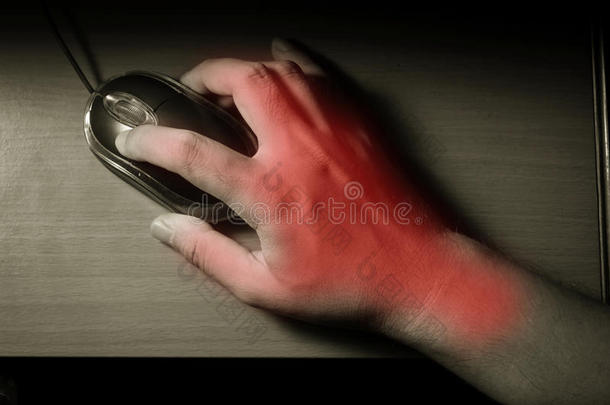 触发手指或腕管综合征。