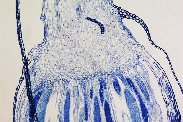 苔藓原丝体显微照片