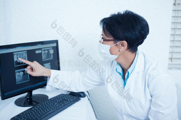 女牙医在电脑上看X光