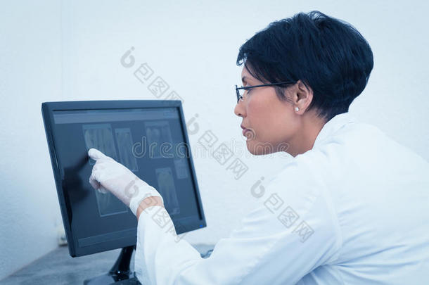 女牙医在电脑上看X光