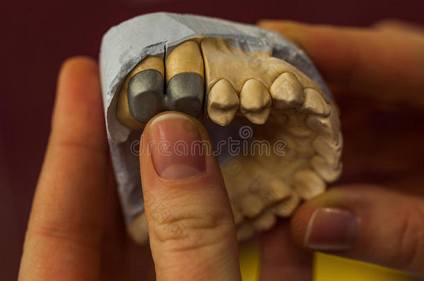 人类牙齿的牙科模具