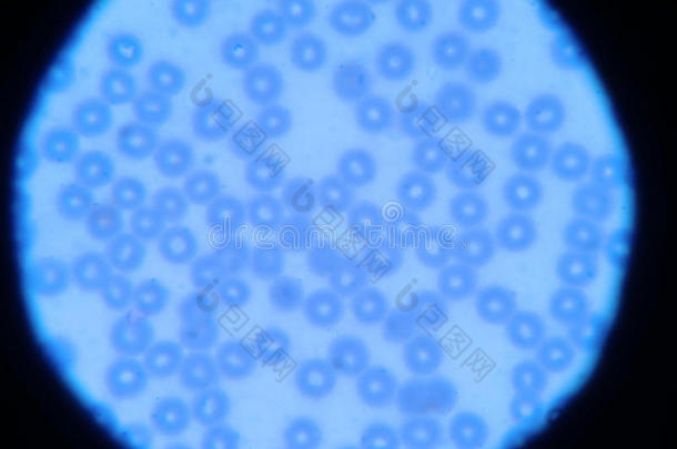 血液涂片：显微镜下红细胞