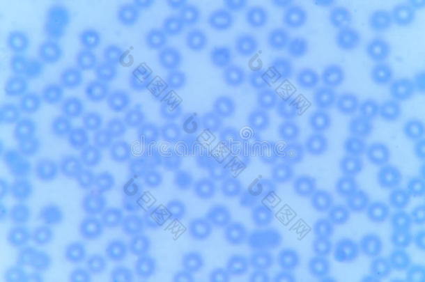 血液<strong>涂片</strong>：显微镜下红细胞