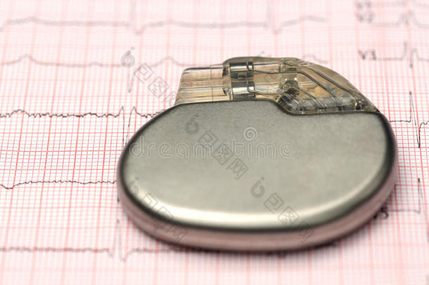 心脏的有氧运动心电图心电图机心脏病学