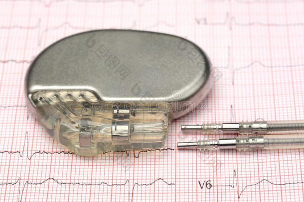 心脏的有氧运动心电图心电图机心脏病学