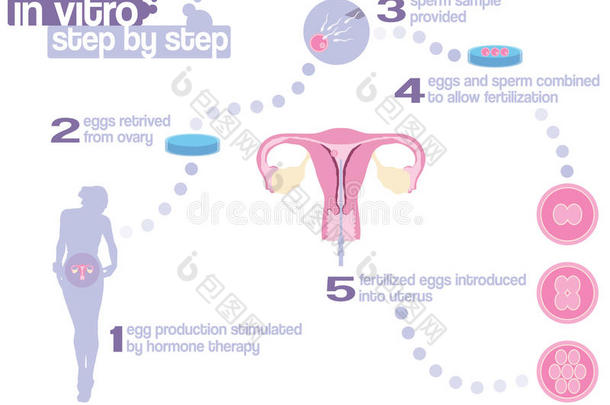 人造的<strong>辅助</strong>的宝贝生物学的出生