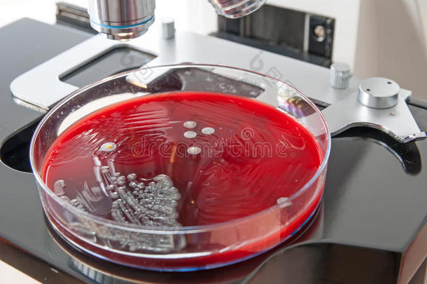 在显微镜下培养皿上的细菌菌落