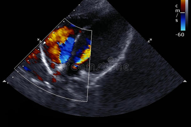 [医]多普勒回声<strong>心动</strong>描记术，多普勒回波<strong>心动</strong>描记术;