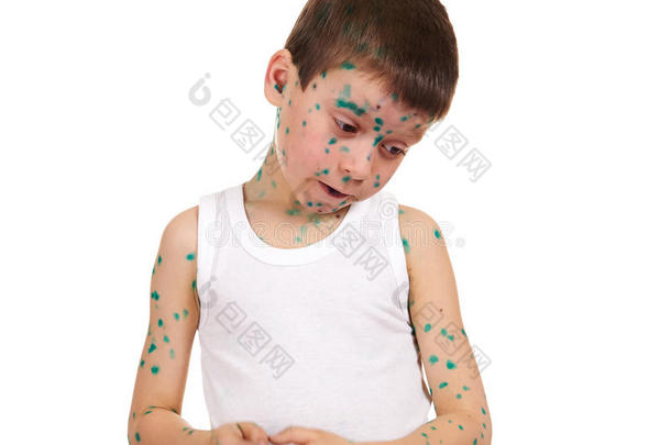 孩子的皮肤上有病毒