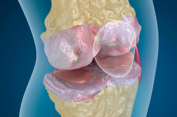 疼痛解剖学的解剖学解剖关节炎
