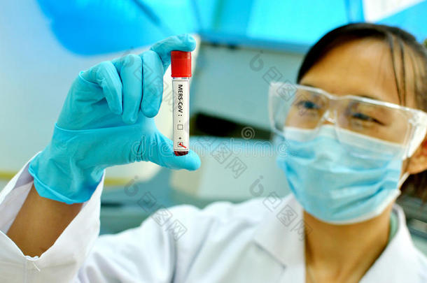 分析生物学血<strong>疾病预防</strong>控制中心常见的