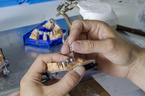 人类牙齿的牙科模具