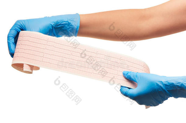 用蓝色消毒手术手套关闭女医生的手，并将心电图结果贴在纸上