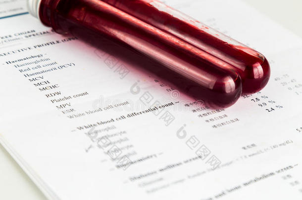 试管中的血液样本与健康分析筛选报告