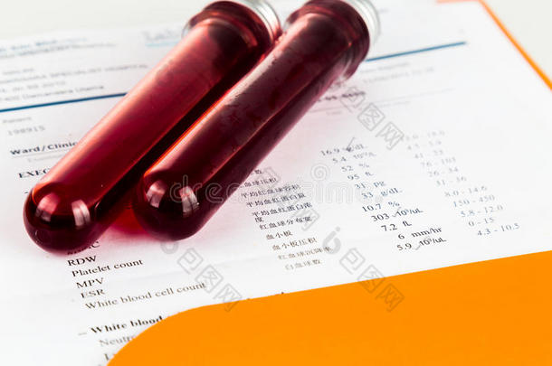试管中的血液样本与健康分析筛选报告