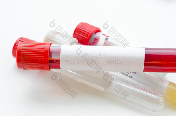血样试验和空管<strong>血液</strong>进行<strong>血液</strong>试验筛选