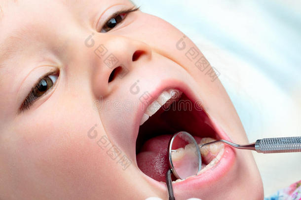 儿童进行牙科检查。