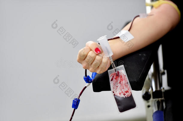 献血者手握拳头