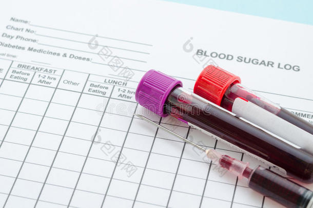 每日血糖日志测试和<strong>取样</strong>血液在管和注射器。